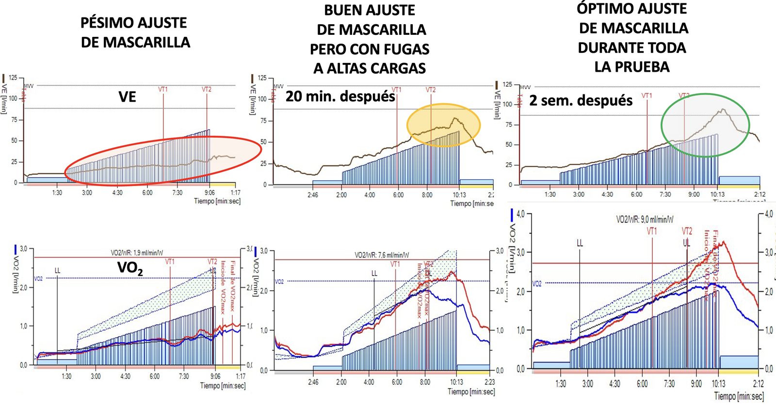 Evolución de la VE y VO2 en las 3 pruebas del paciente