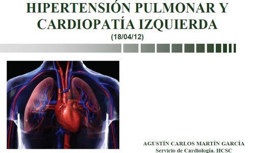 Hipertensión Pulmonar y Cardiopatía Izquierda