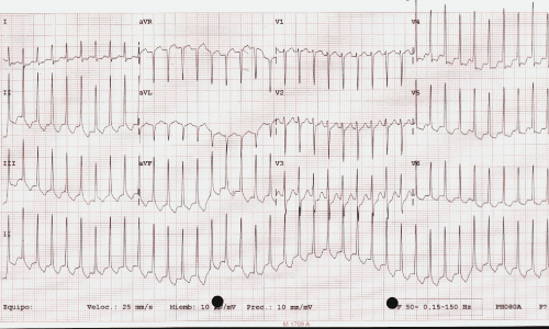 Paciente asintomático con trasplante renal