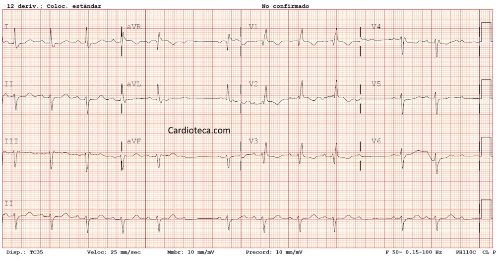 ECG 1 junio 2026