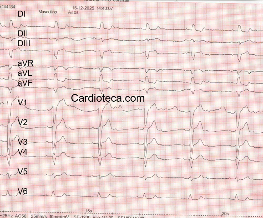 ECG 2 febrero 2026