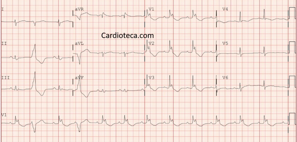 ECG 3 agosto 2026
