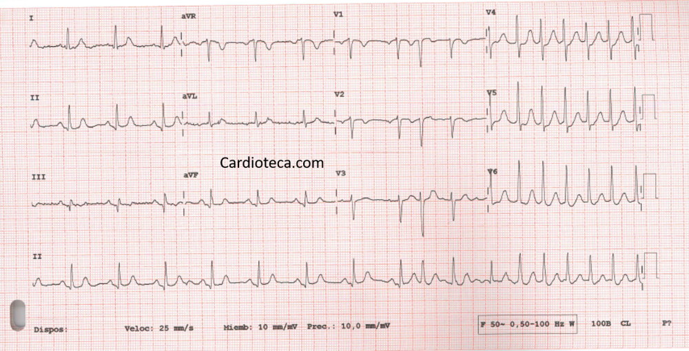 ECG 5 octubre 2026