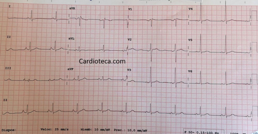 ECG 6 julio 2026