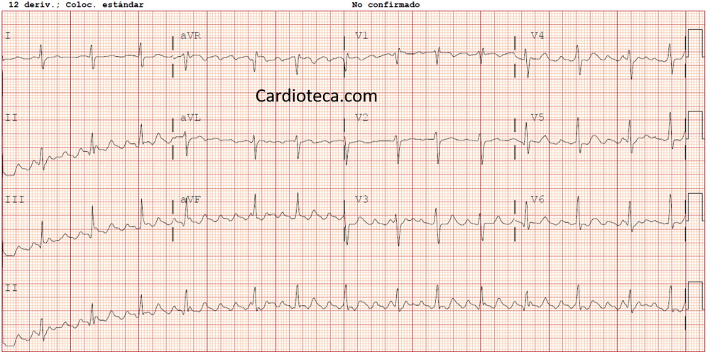 ECG 7 septiembre 2026