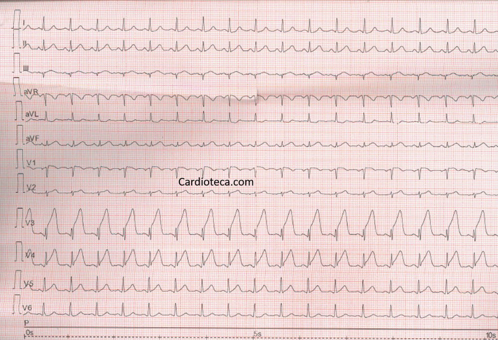 ECG 8 junio 2026