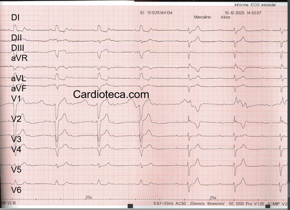 ECG 9 febrero 2026