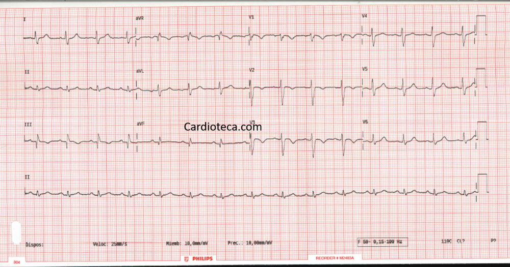ECG 9 marzo 2026