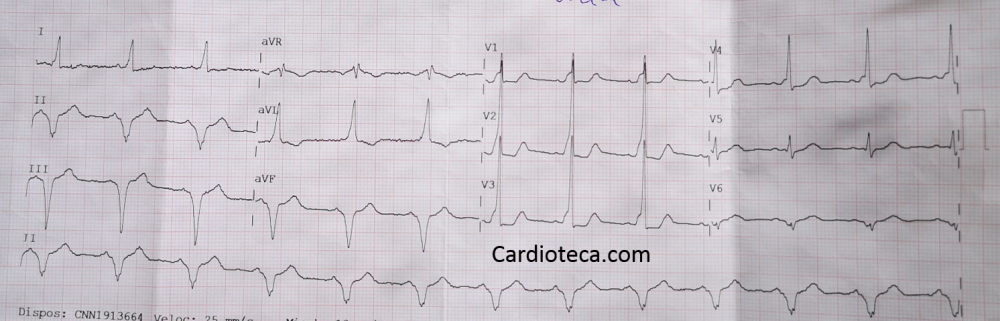 ECG 10 agosto 2026