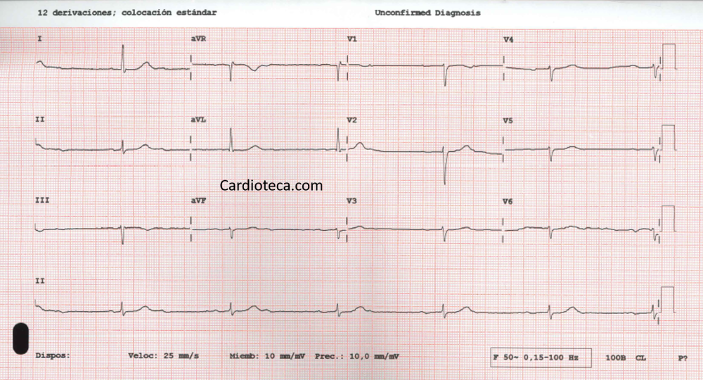 Ni Sherlock Holmes…