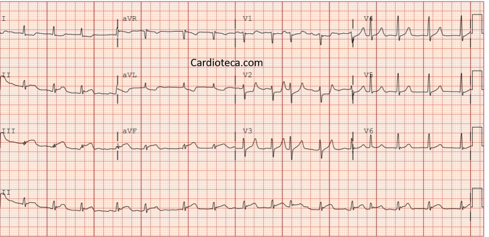 ECG 12 octubre 2026