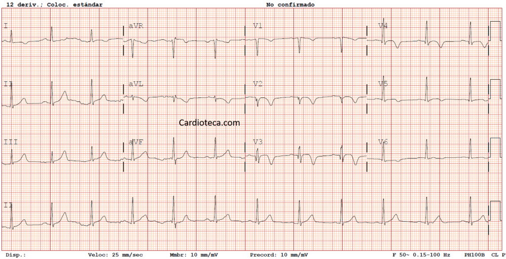 ECG 13 julio 2026