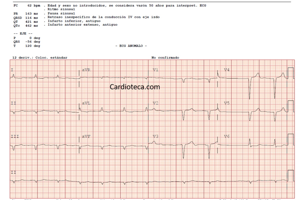 ECG 14 septiembre 2026