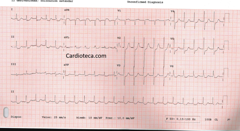 ECG 15 diciembre 2025