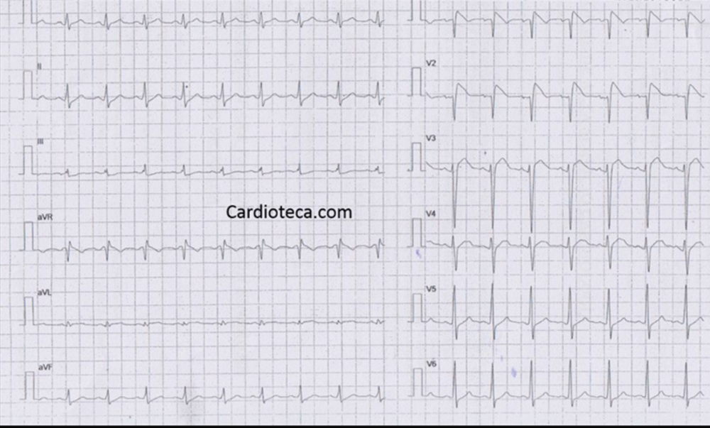 ECG 17 agosto 2026