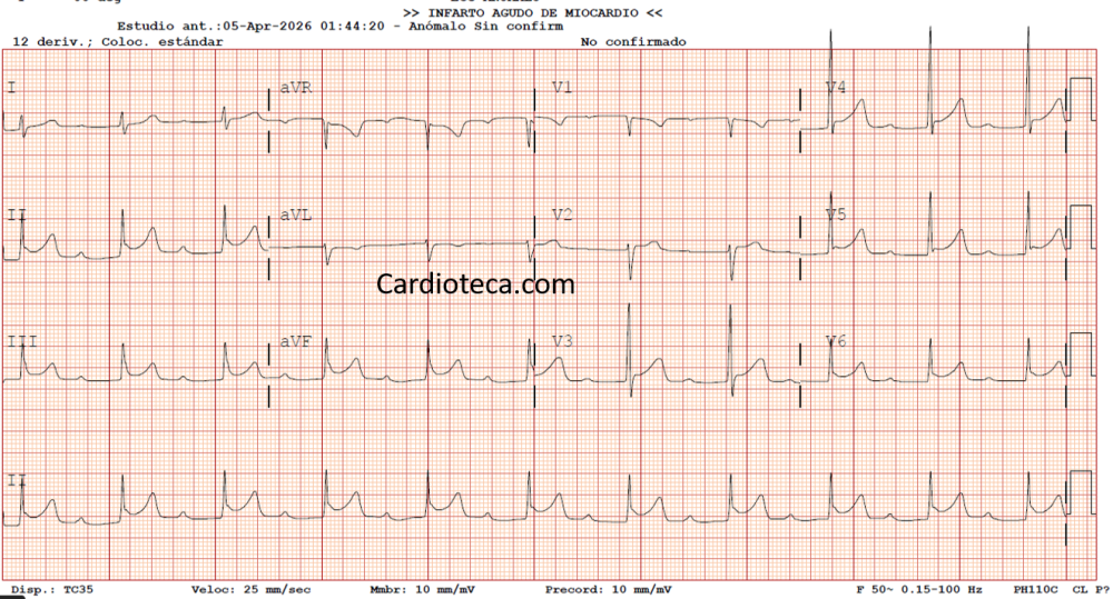 ECG 18 mayo 2026