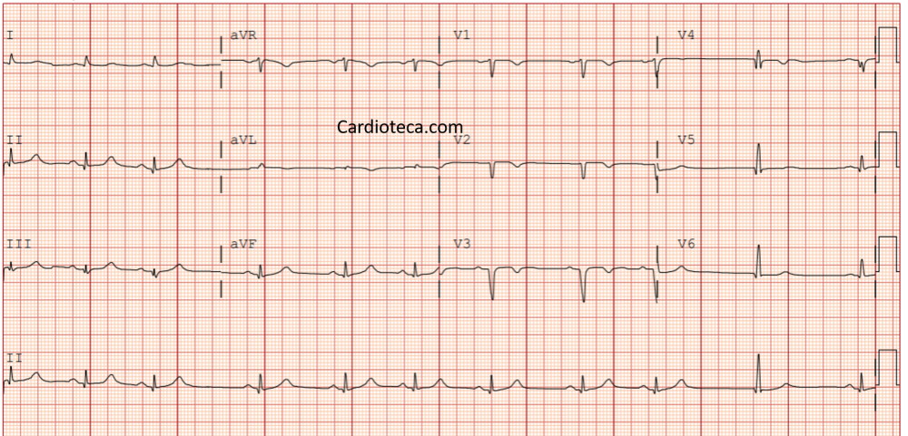 ECG 19 octubre 2026