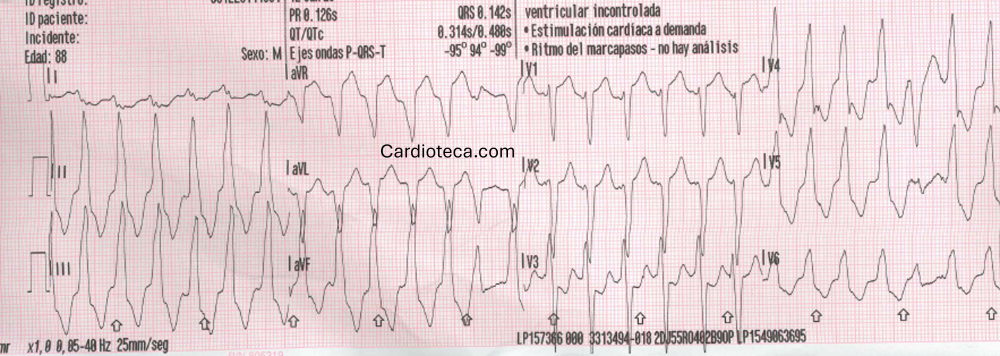 ECG 20 julio 2026