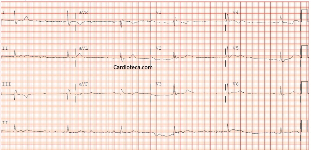 ECG 21 septiembre 2026