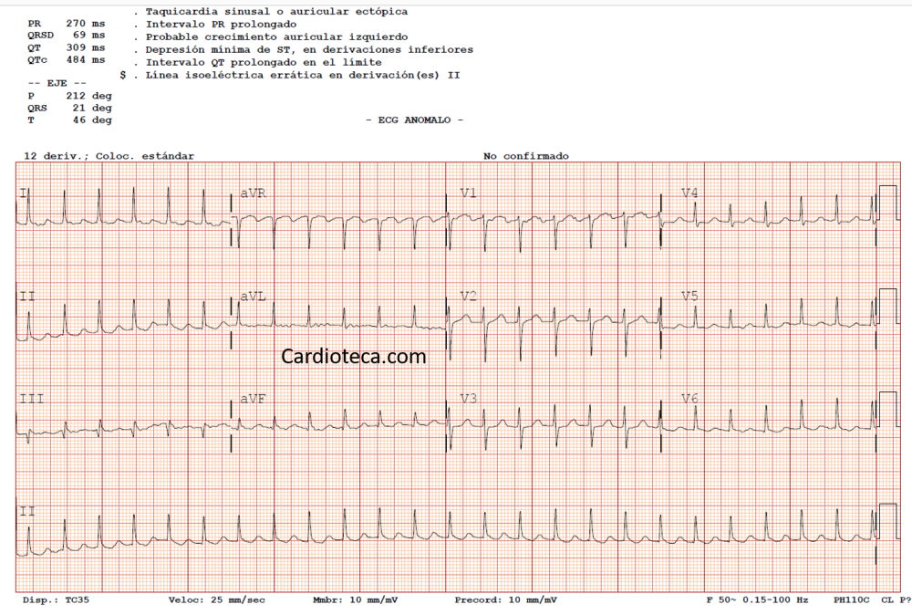 ECG 22 junio 2026