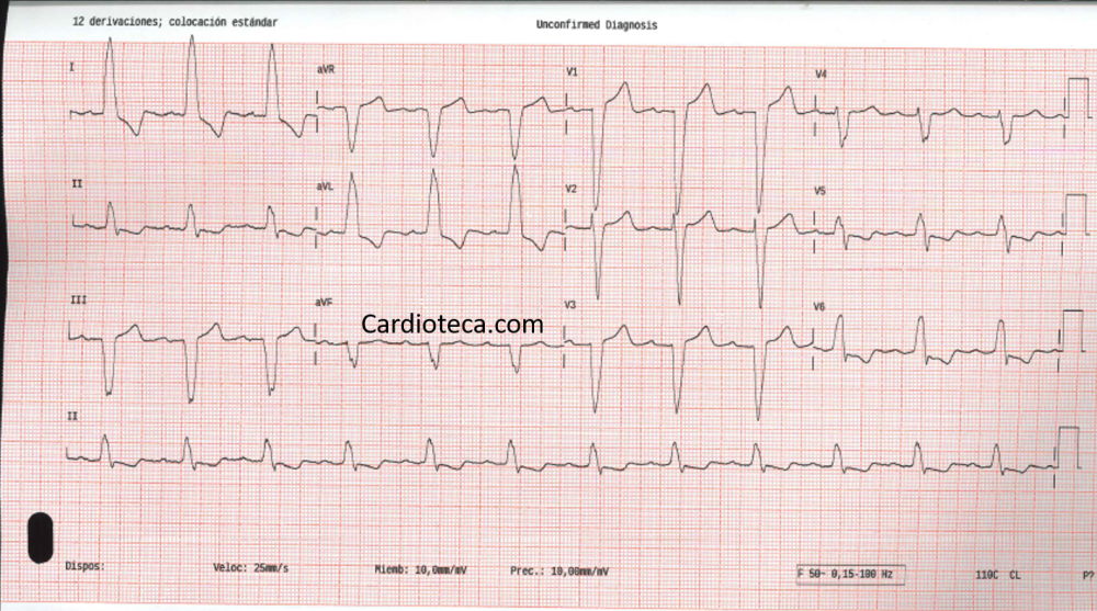 ECG 23 marzo 2026