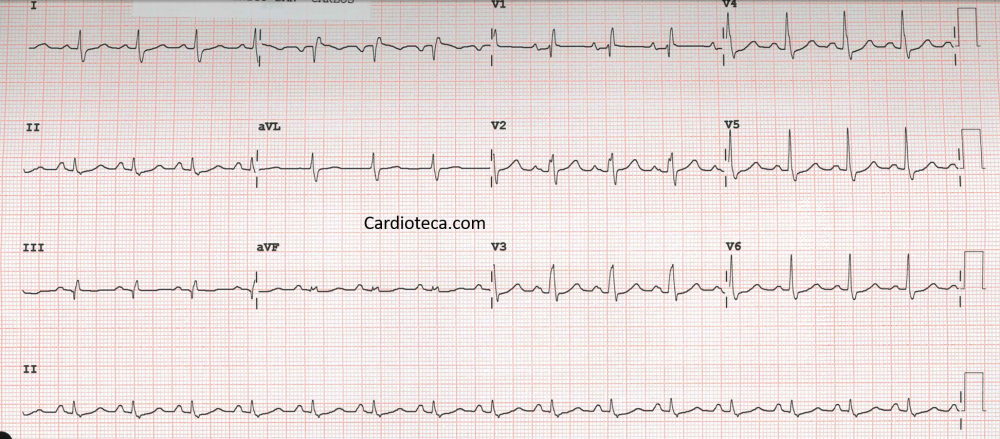 ECG 24 agosto 2026