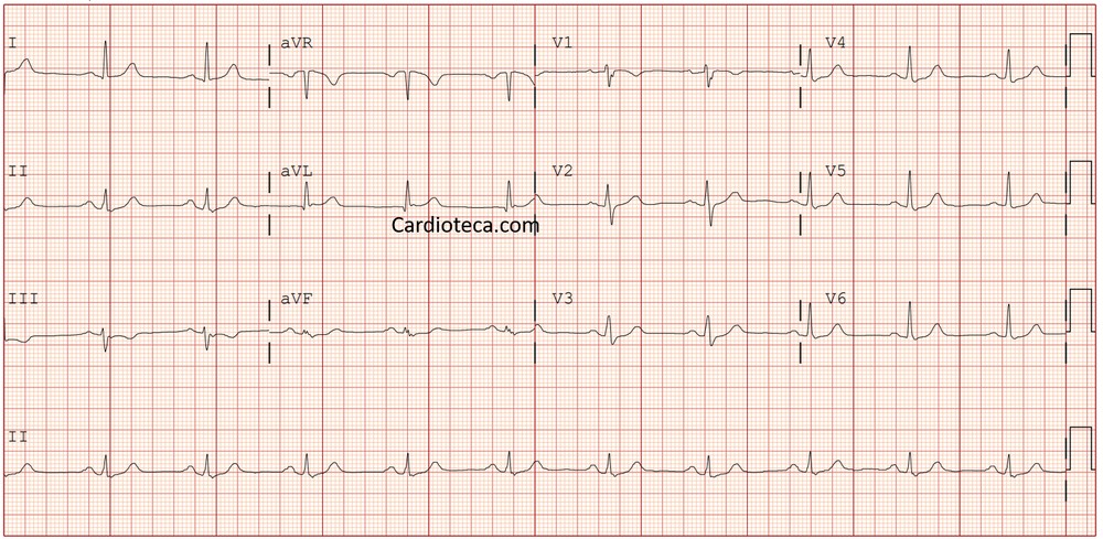 ECG 26 octubre 2026