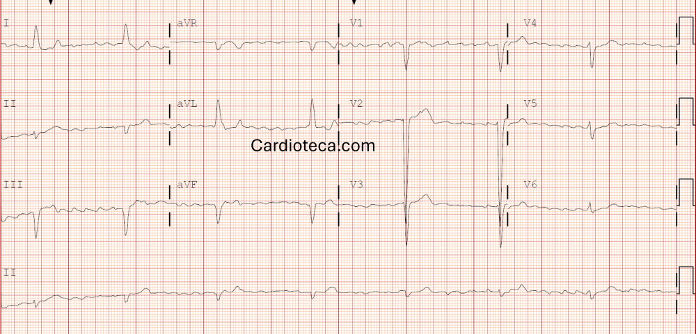 ECG 27 julio 2026
