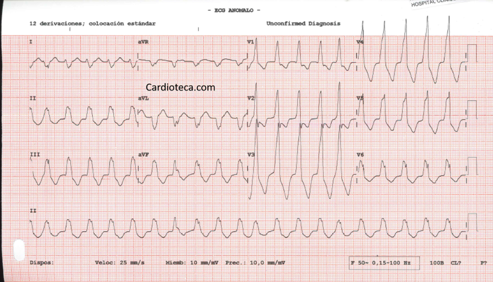 Esas taquicardias que dan miedito