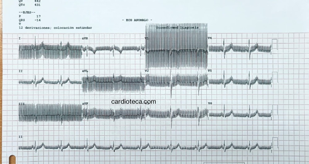 ECG 28 septiembre 2026