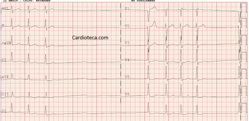 ECG 29 junio 2026