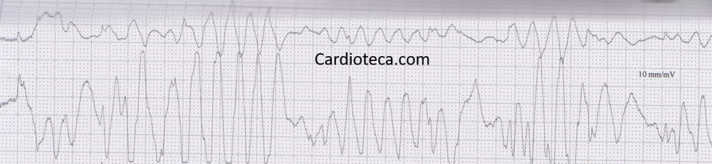 ECG 31 agosto 2026