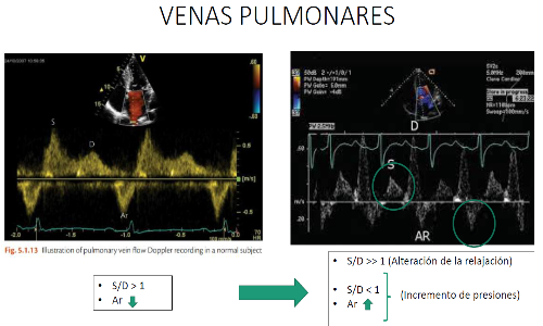 Ecocardiografía y disfunción diastólica