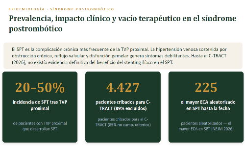 Síndrome postrombótico: el C-TRACT demuestra por primera vez que el stenting ilíaco funciona