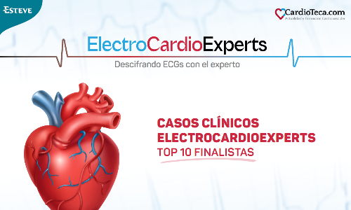 Top 10 casos ElectroCardioExperts - 2025