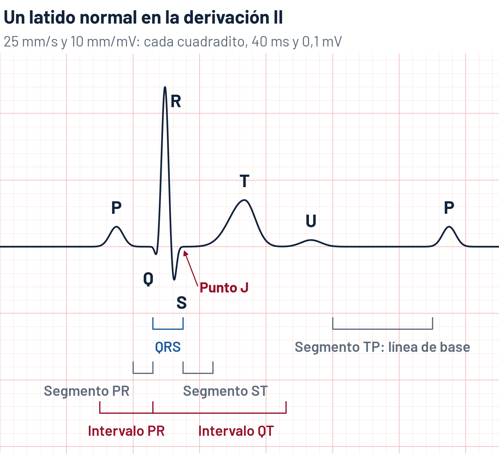 Esquema de un latido normal de ECG en la derivación II, a 25 mm/s y 10 mm/mV: onda P de 100 ms, intervalo PR de 160 ms, QRS de 90 ms con ondas Q, R y S, punto J al final del QRS, segmento ST isoeléctrico, onda T positiva, onda U pequeña 200 ms después del pico de la T, intervalo QT de 400 ms y segmento TP como línea de base, con un RR de 1 segundo (60 lpm)