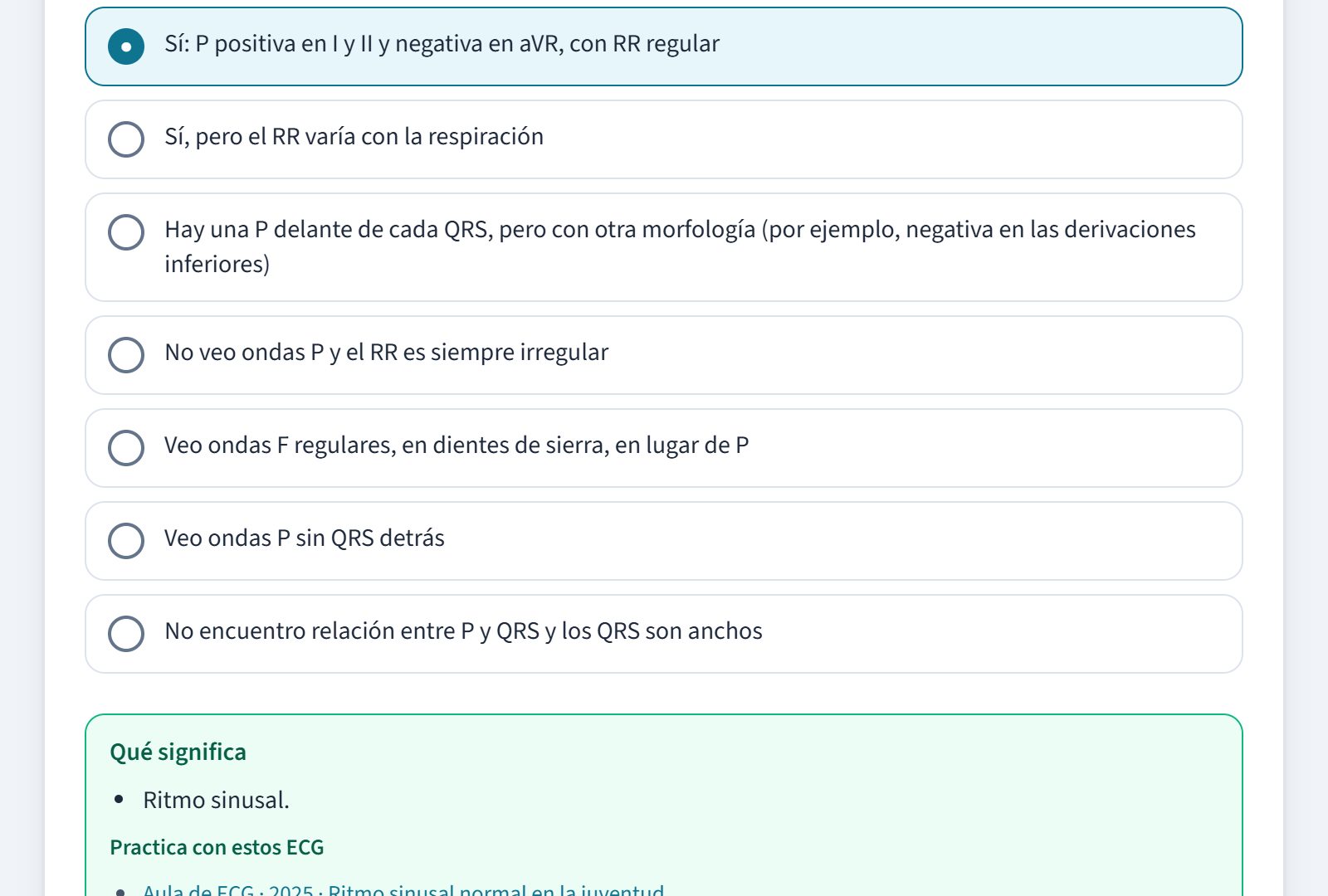 Paso 2, ritmo: marcada la P positiva en I y II y negativa en aVR con RR regular y, debajo, qué significa: ritmo sinusal